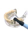 dental-implant-detector-easydo-detector-three-dimensional-implant-locator-system-kit-5pcs-removable-270-rotating-sensor-head (4)